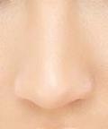 Januar | 2014 |  Blog zum Thema Nasenkorrektur, Nasenoperation, Nasen OP Nasenscheidewand Operationen